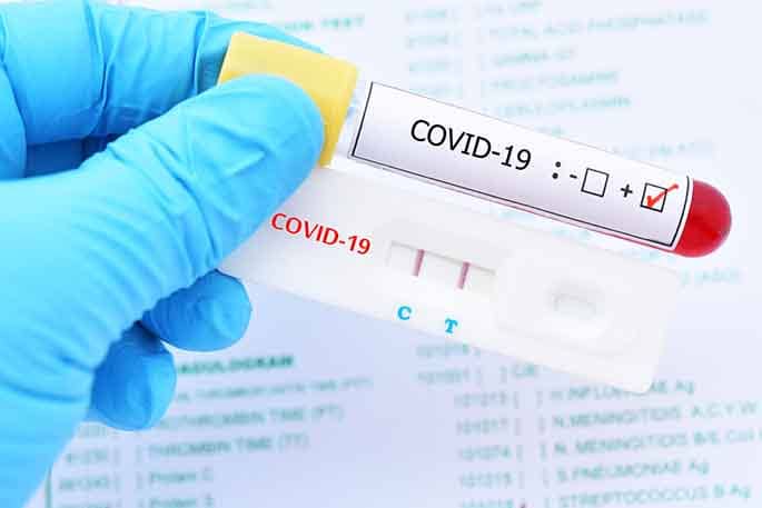 covid coronavirus pcr prueba negativa traductor jurado oficial Translation-Traducción